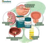 Hiamlaya Cystone For Healthy Kidneys-100tab - Image 6